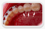 Reablitao Oral
