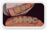 Reabilitao Oral