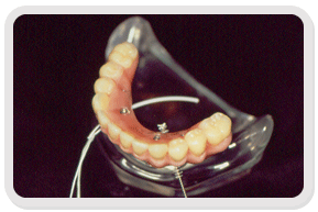 Reabilitao Oral