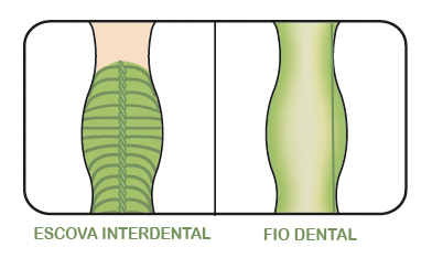 Escova Interdental Comparativo