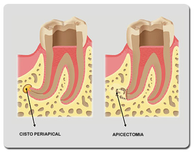 Endodontia