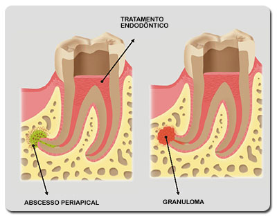 Endodontia