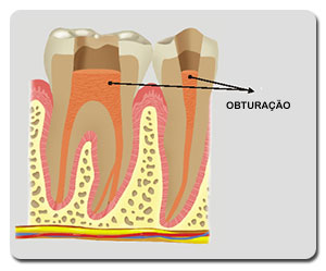 Endodontia
