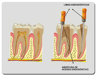 Endodontia