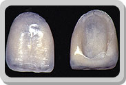 Esttica
