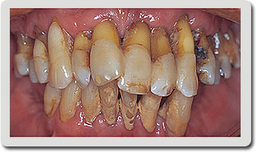 Periodontia