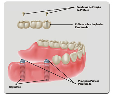 Reabilitao Oral